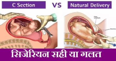 cesarean delivery effected your life