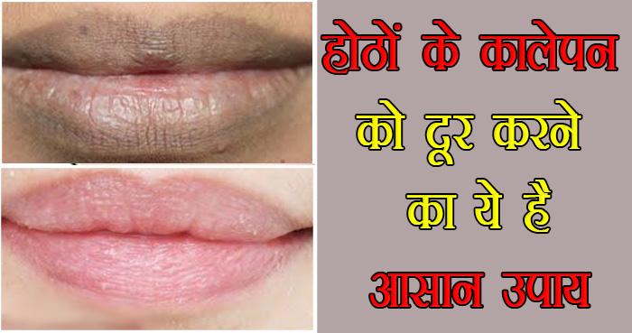 lips beauty blackness care tips