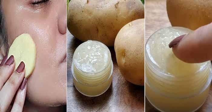 no soap apply potato gel daily on face to remove dark spots