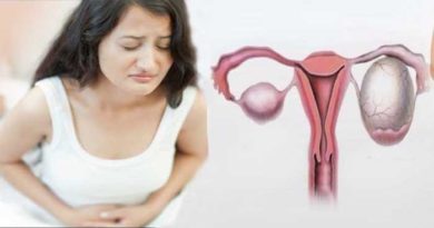 ovarian cysts symptom and solution