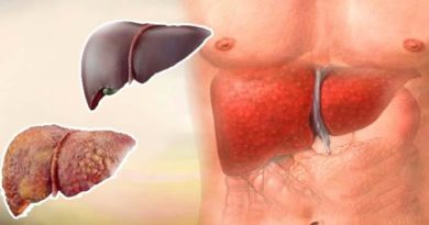 panacea cure to manage enlarged liver