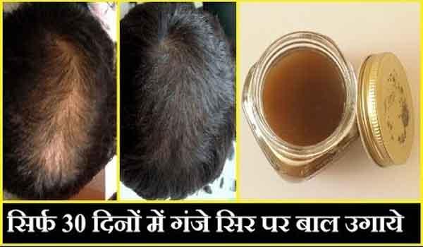 this tremendous home remedies will stop hair loss only for the first time