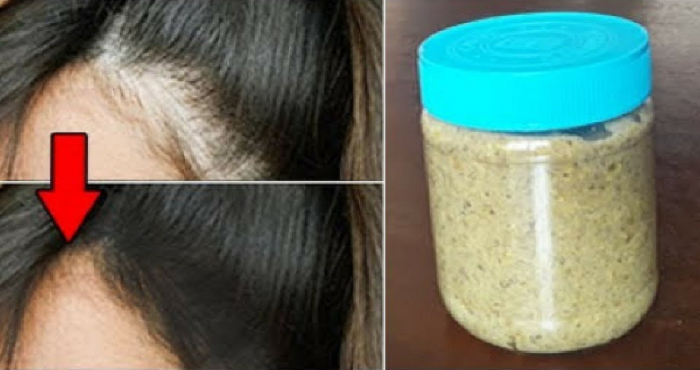 use these home remedies and stop your haire fall