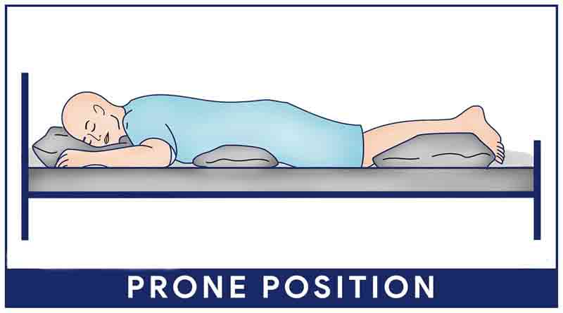 prone position