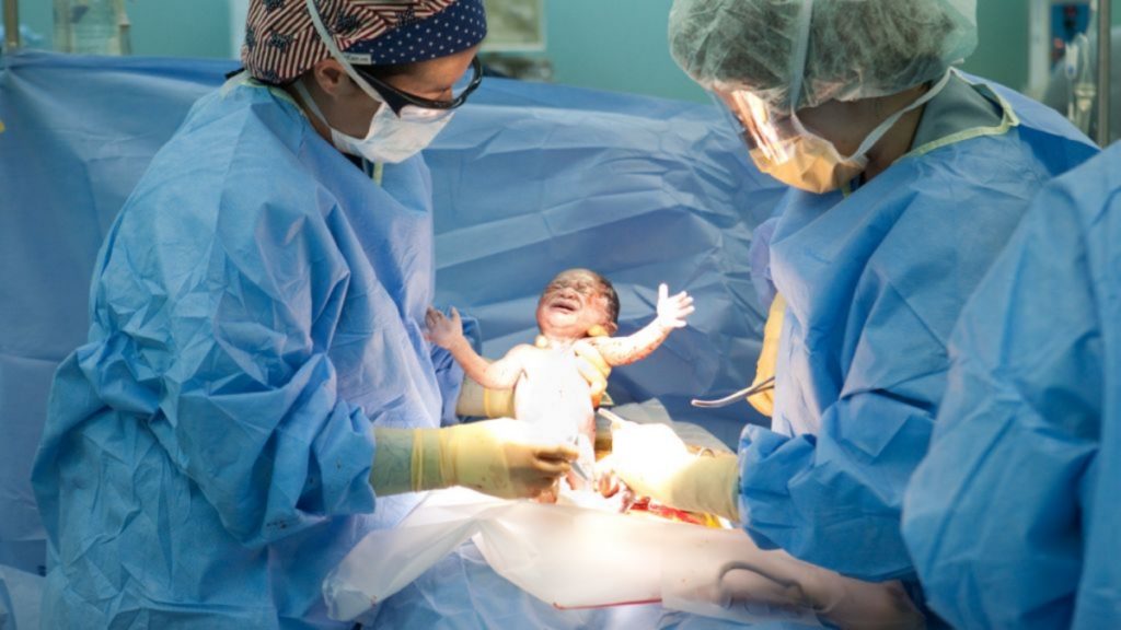 cesarean operation 1539418974